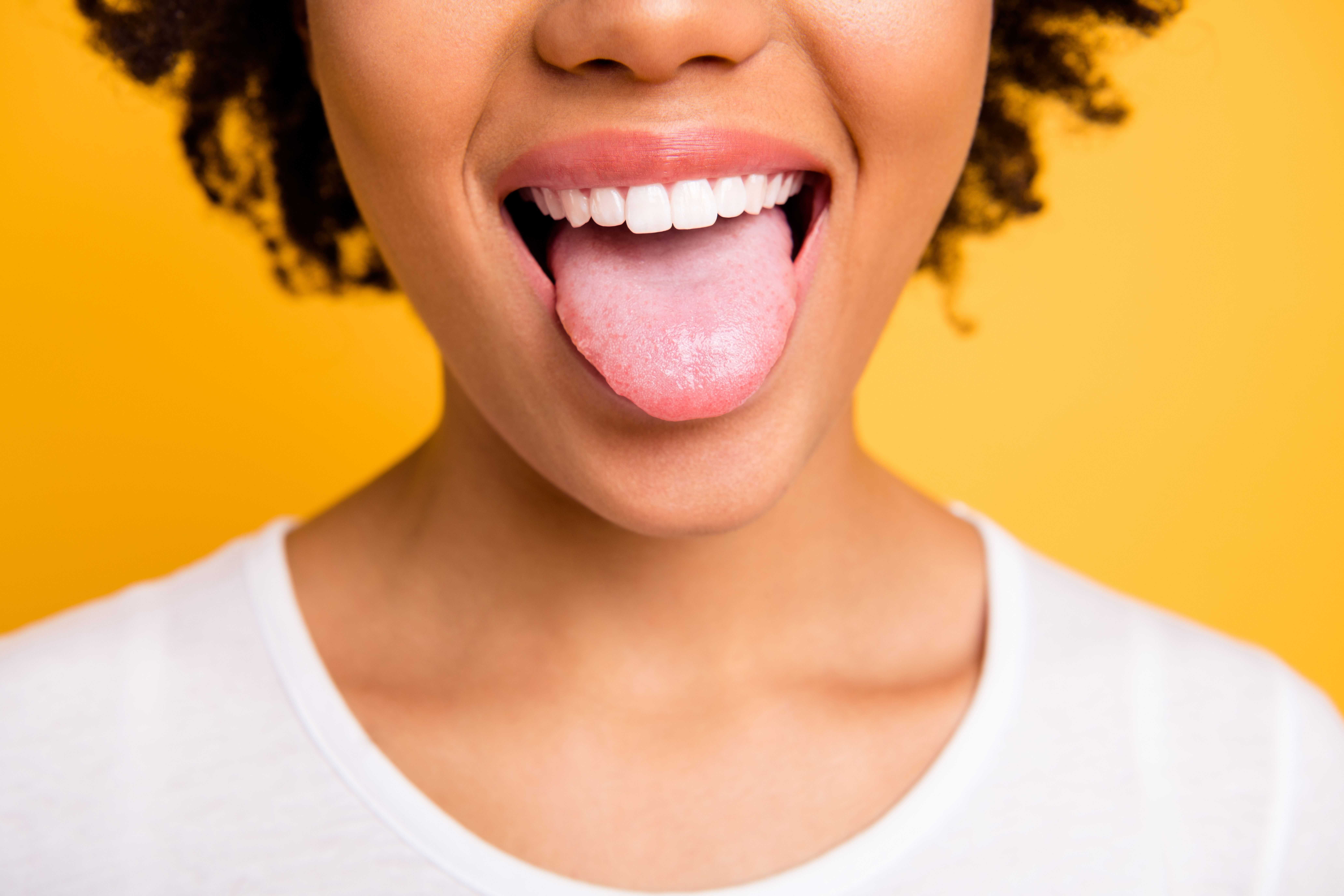 11 Reasons for Bumps on the Back of Your Tongue