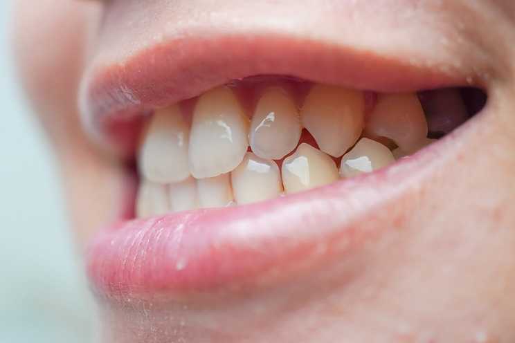 Teeth Talk Girl | Your Guide To A Healthy Smile