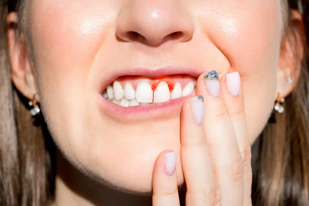 No, Your Gums Aren’t Bleeding Because the Floss is Cutting Them