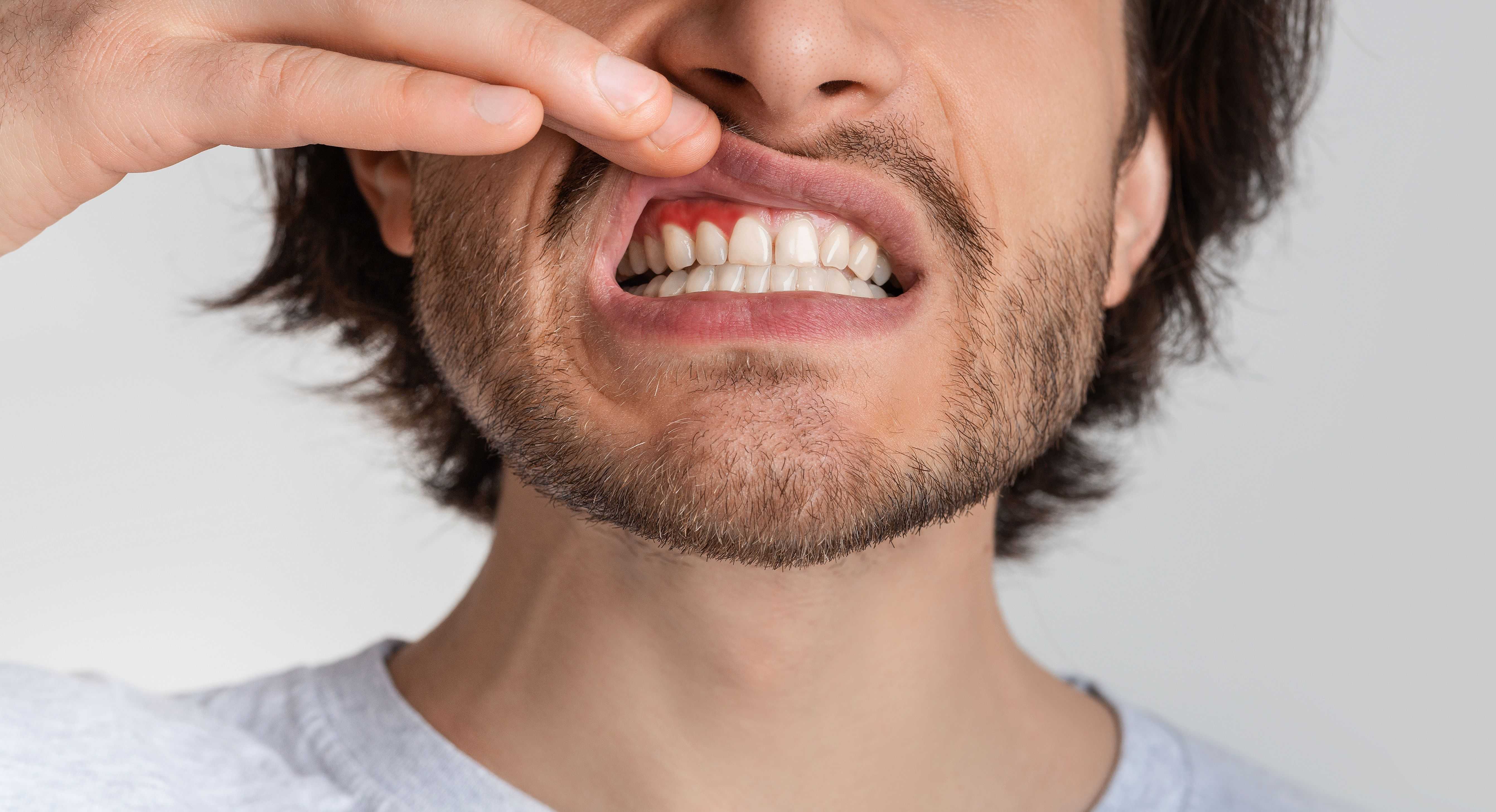 Can Gum Disease Kill You? Yes, Here's How