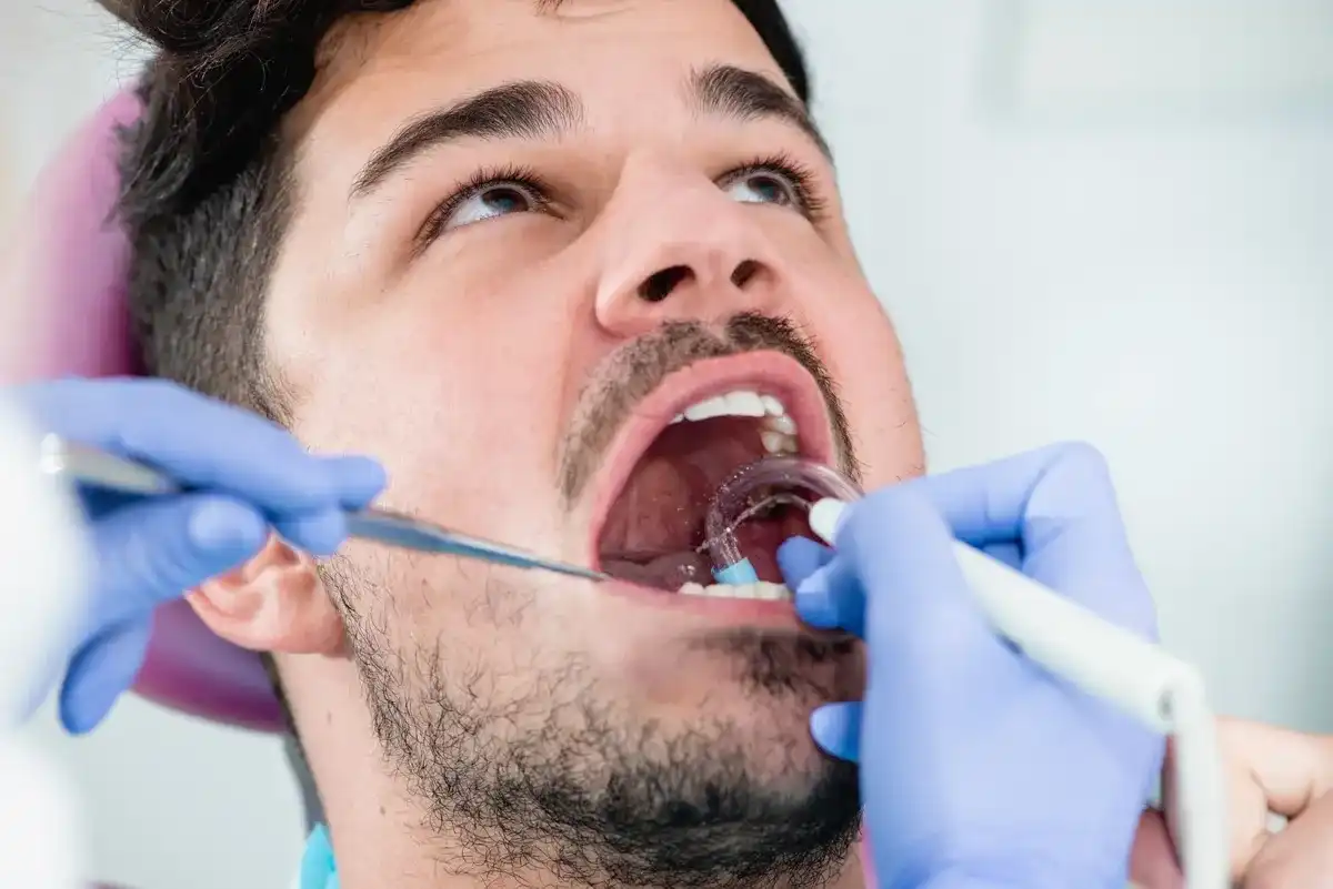 How Long Should A Teeth Cleaning Take?