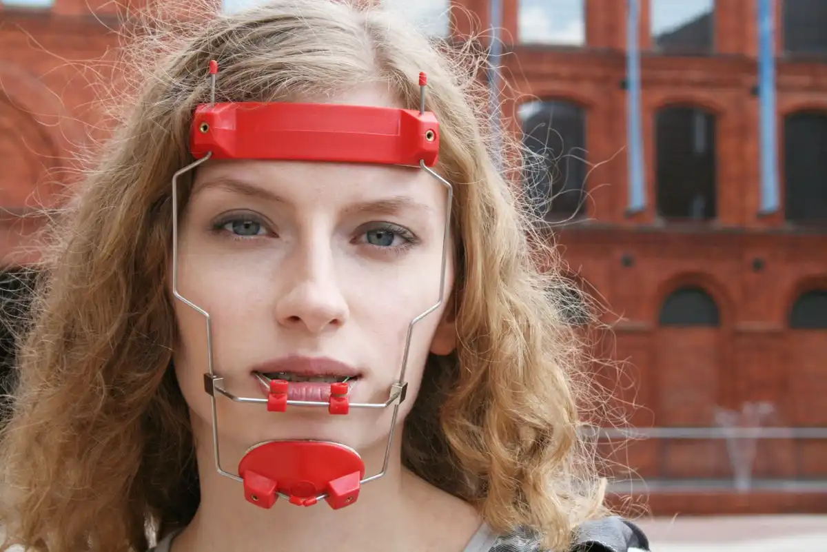 Are Orthodontic Headgear Braces Worth it? 