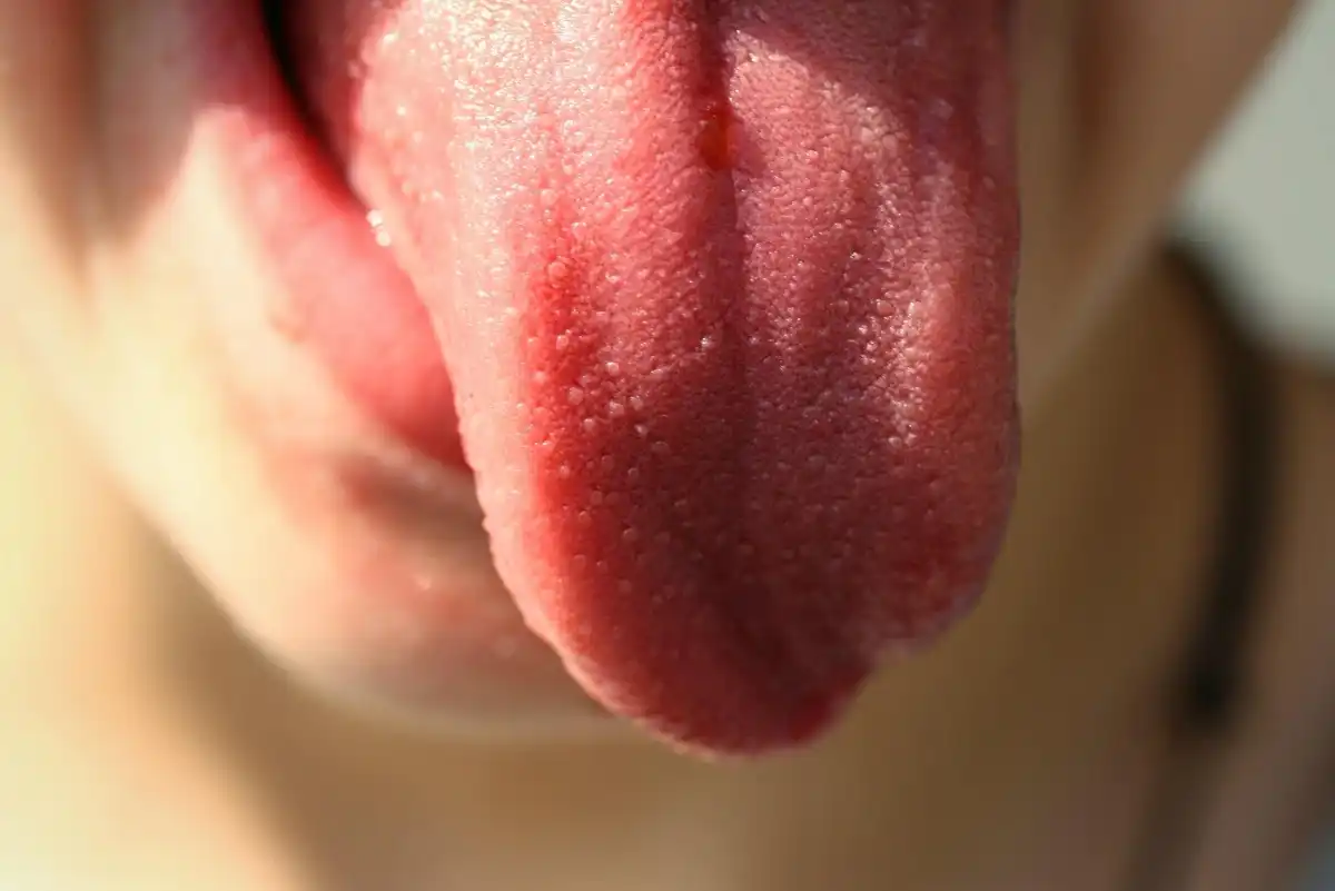 7 Reasons Why Your Tongue Is Itchy: Causes & Treatments