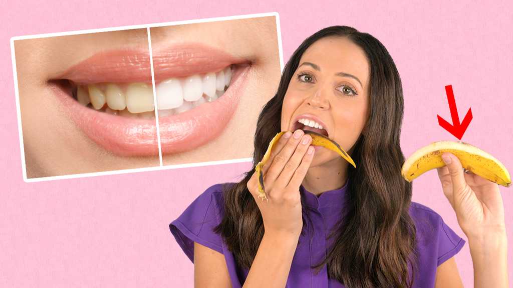 View of Banana Peel Teeth Whitening: Does it work?