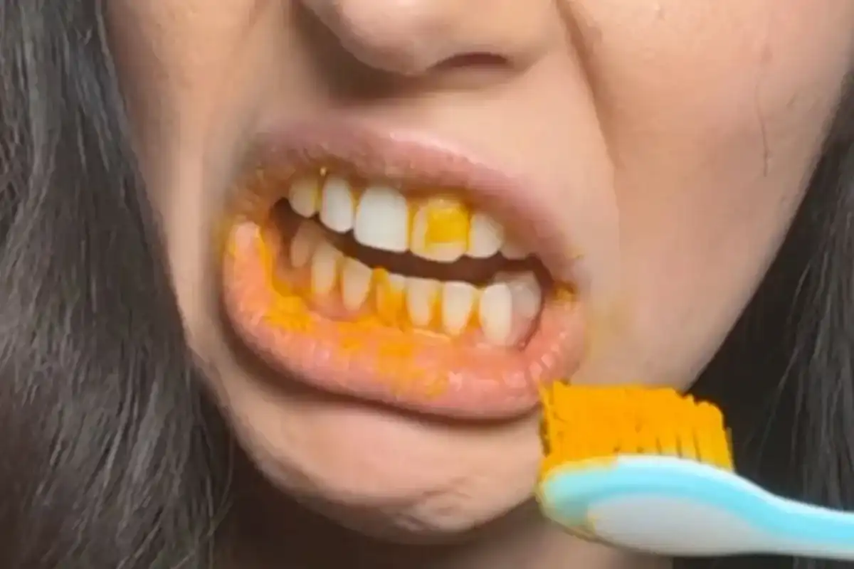 Is Turmeric Teeth Whitening A Tiktok Fad Or Does It Really Work?