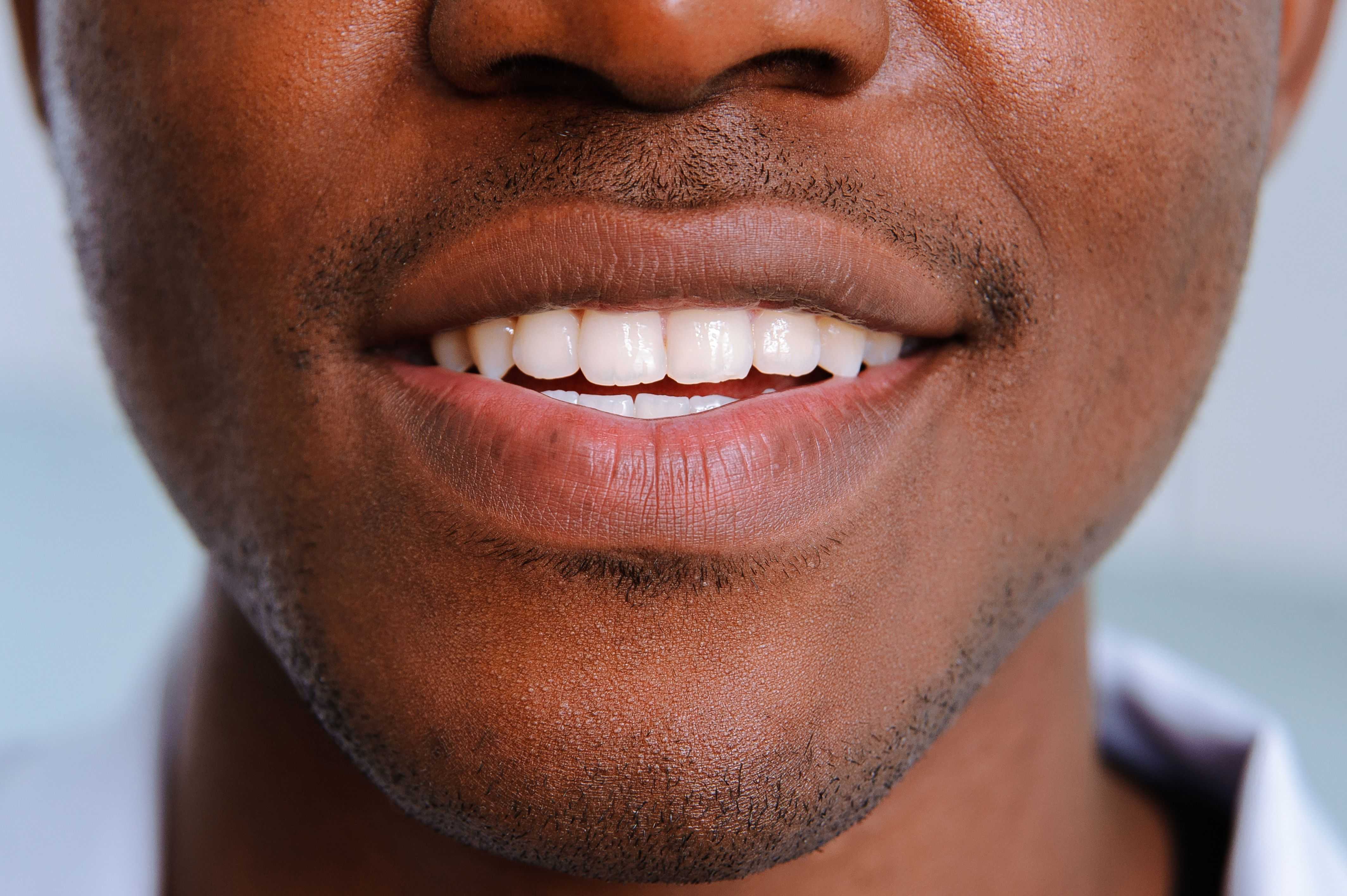 8 Reasons Why Are My Gums Peeling Off?