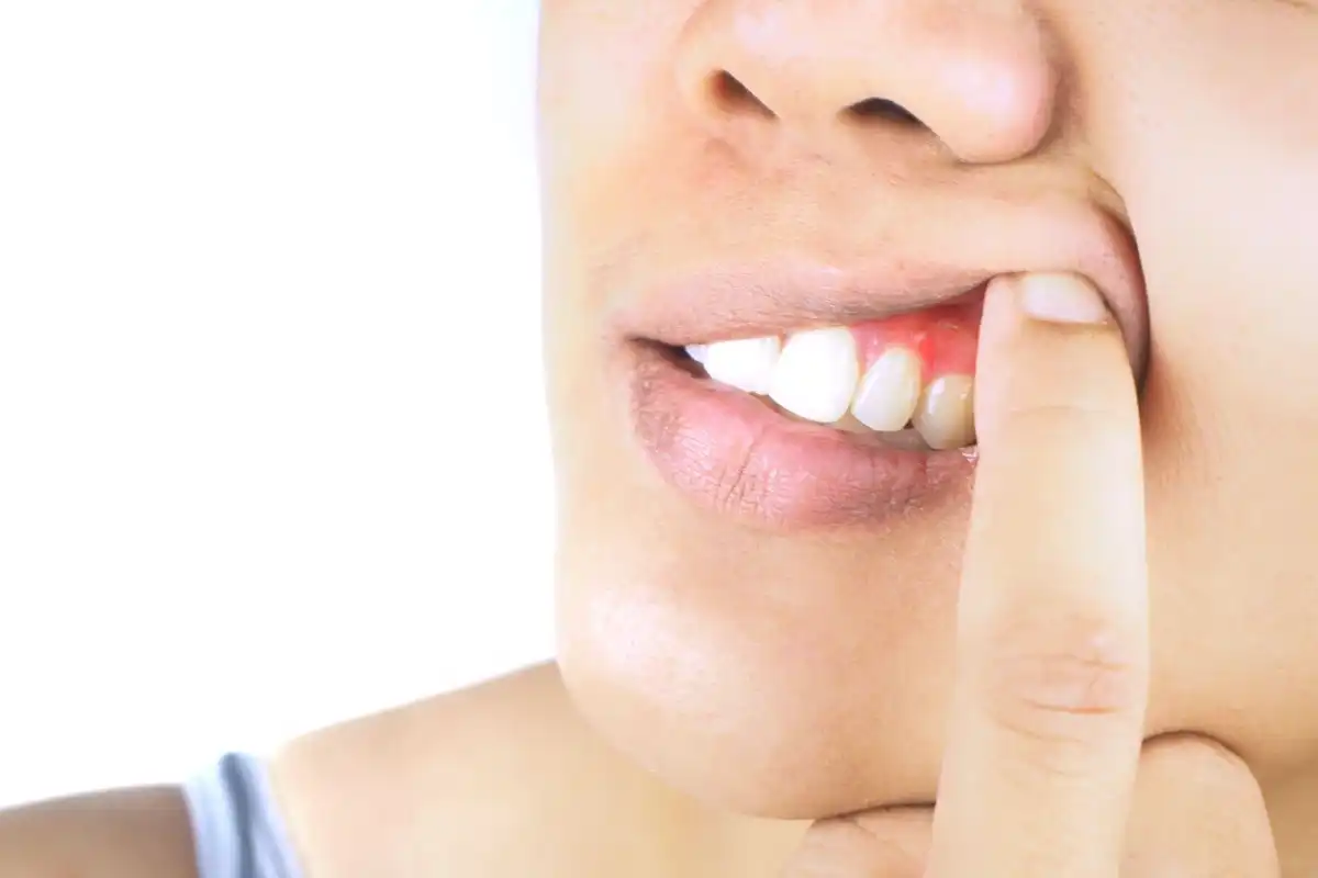 11 Reasons Why Your Gums Are Sore