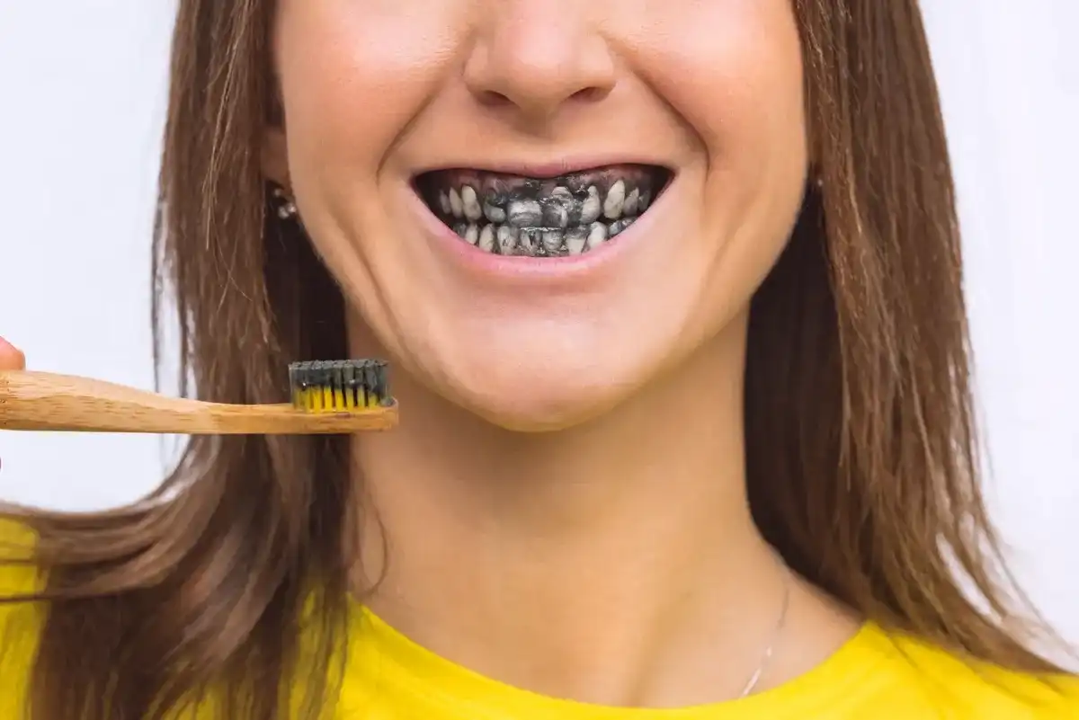 Do Charcoal & Whitening Toothpastes Actually Whiten Teeth?