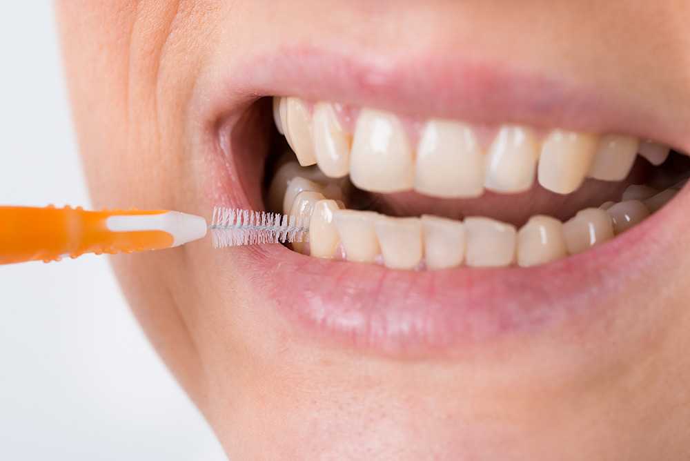 Interdental Brushes