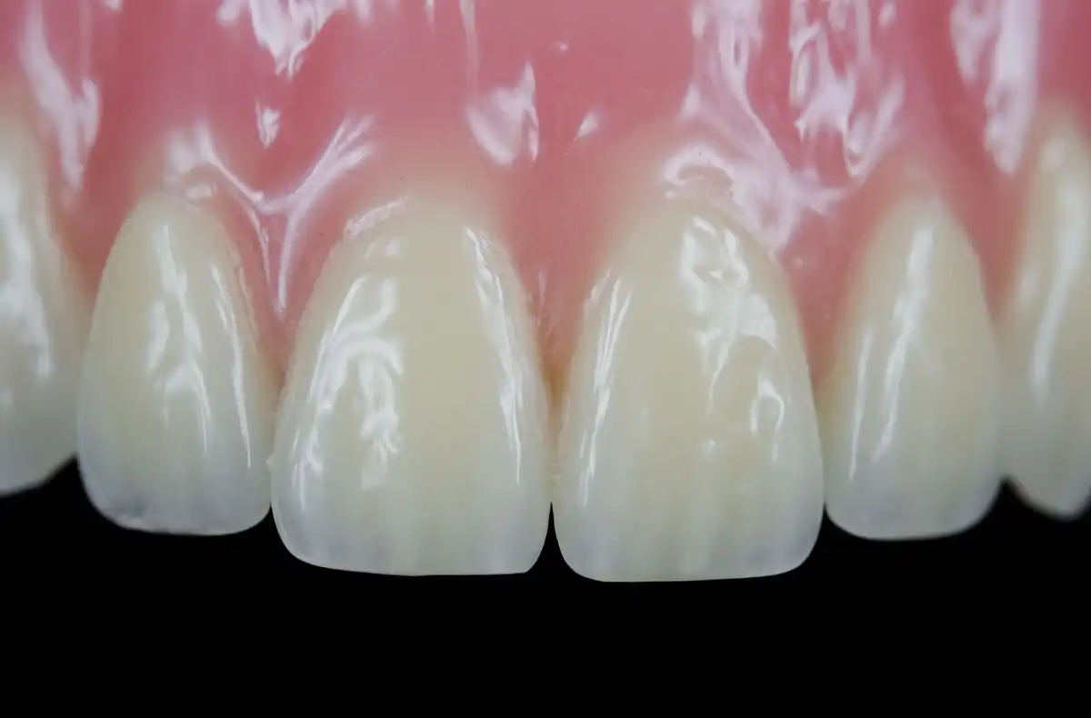 Thinning Enamel? How to Spot Enamel Loss & Damage 