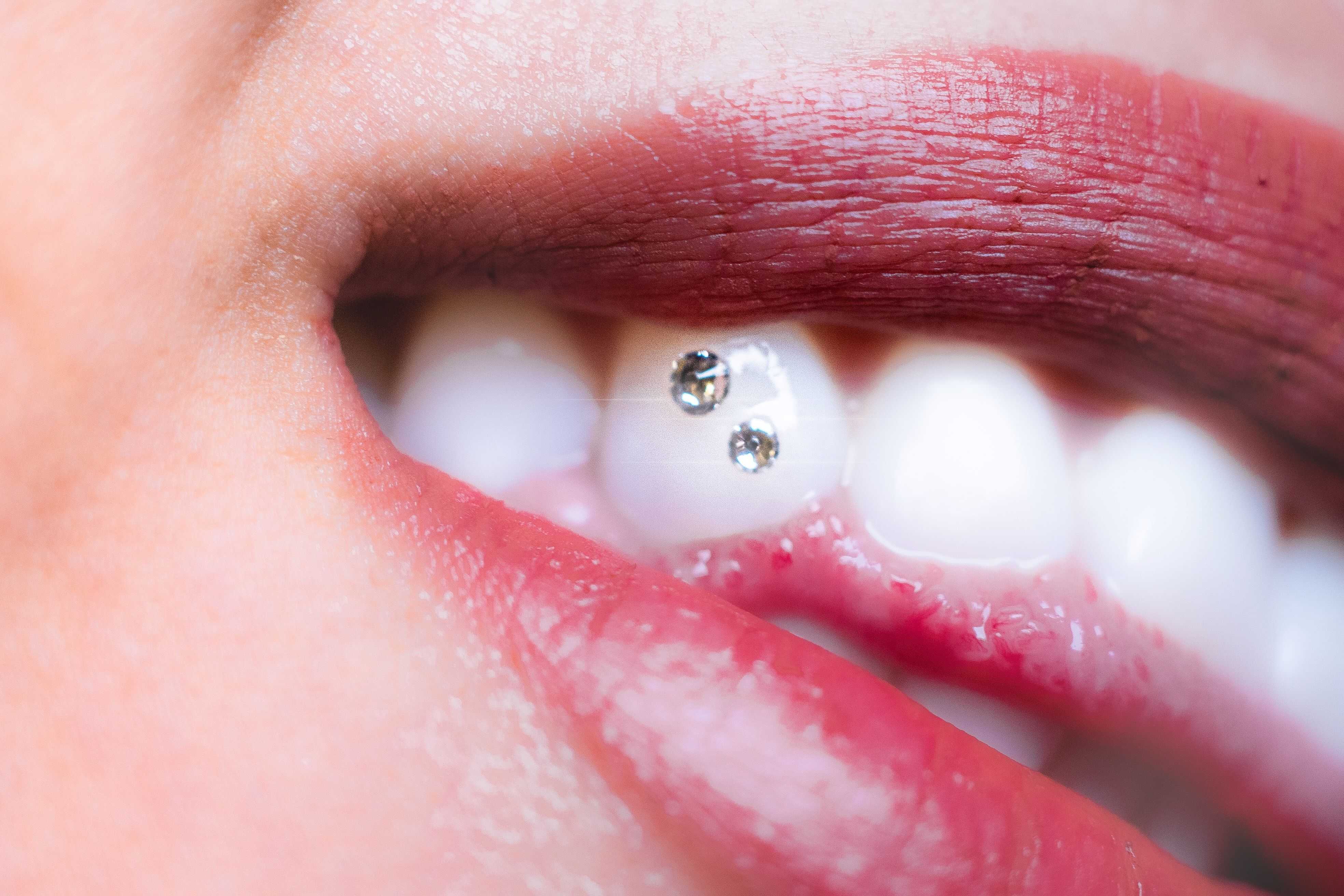 Everything you need to know about tooth gems and grillz - The Face