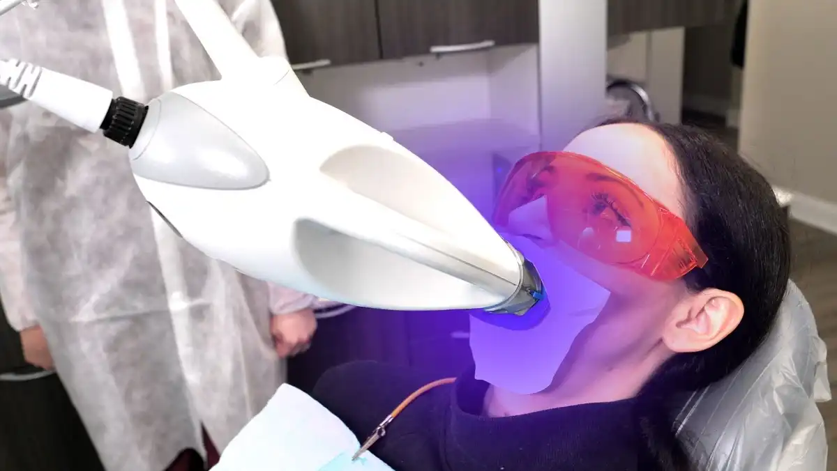 Teeth Whitening At The Dentist: Procedure & Cost 